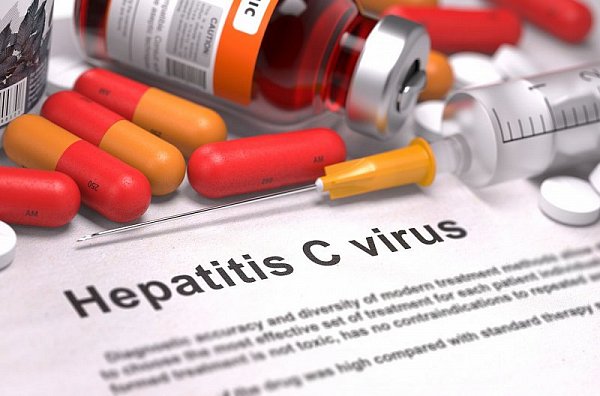 Virová hepatitida typu C